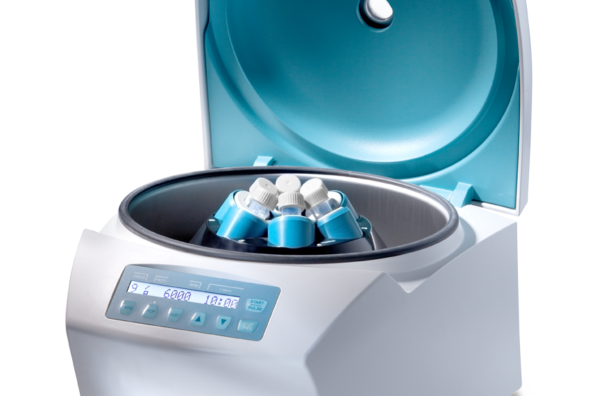 What You Need to Know About Serological Centrifuges hospitalninojesus