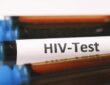 HIV Test Dubai