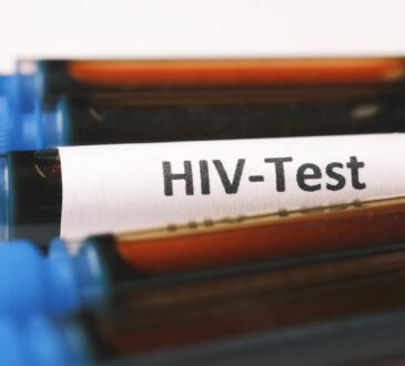 HIV Test Dubai