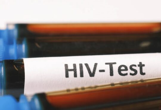 HIV Test Dubai