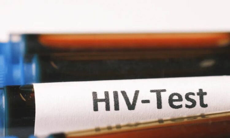 HIV Test Dubai