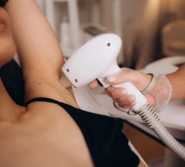 Laser Hair Removal
