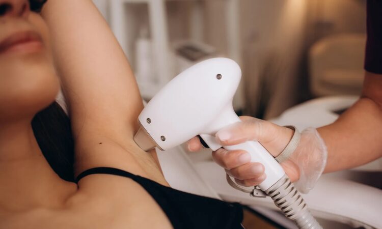 Laser Hair Removal